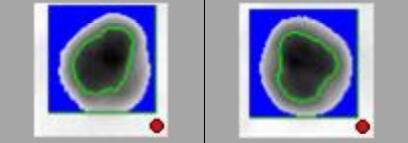 Badly soldered balls BGA PCB soldering